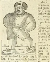 An illustration from Anthropometamorphosis: man transform'd: or, The artificiall changling, historically presented, in the mad and cruel gallantry, foolish bravery, ridiculous beauty, filthy finenesse, and loathsome loveliness of most nations, fashioning and altering their bodies from the mould intended by nature; with figures of those transformations. To which artificial and affected deformations are added, all the native and national monstrosities that have appeared to disfigure the humane fabrick. With a vindication of the regular beauty and honesty of nature (1653)