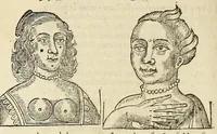 Picture 63 of 64 from Anthropometamorphosis: man transform'd: or, The artificiall changling, historically presented, in the mad and cruel gallantry, foolish bravery, ridiculous beauty, filthy finenesse, and loathsome loveliness of most nations, fashioning and altering their bodies from the mould intended by nature; with figures of those transformations. To which artificial and affected deformations are added, all the native and national monstrosities that have appeared to disfigure the humane fabrick. With a vindication of the regular beauty and honesty of nature (1653), leaf 606
