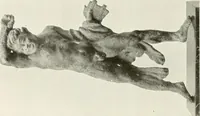 An illustration from Antike Bronzestatuetten (1921)