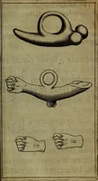 An illustration from Thomae Bartholini Antiqvitatvm Veteris pverperii synopsis a filio Casparo Bartholino commentario illustrata (1676)
