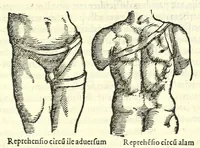 An illustration from Galeni librorum septima classis : curativum methodum tum diffuse tum breviter descriptam, victus rationem in morbis acutis, singulorum morborum facile paranda remedia, privatam quorundam morborum curationem, chirurgie constitutionem, fracturarum ac luxationum sanationem, fasciarum deniq ; & laqueorum & machinamentorum tractatum continet (1576)