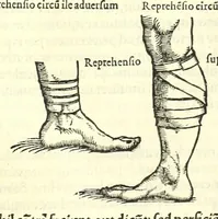 An illustration from Galeni librorum septima classis : curativum methodum tum diffuse tum breviter descriptam, victus rationem in morbis acutis, singulorum morborum facile paranda remedia, privatam quorundam morborum curationem, chirurgie constitutionem, fracturarum ac luxationum sanationem, fasciarum deniq ; & laqueorum & machinamentorum tractatum continet (1576)