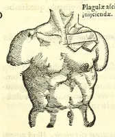 An illustration from Galeni librorum septima classis : curativum methodum tum diffuse tum breviter descriptam, victus rationem in morbis acutis, singulorum morborum facile paranda remedia, privatam quorundam morborum curationem, chirurgie constitutionem, fracturarum ac luxationum sanationem, fasciarum deniq ; & laqueorum & machinamentorum tractatum continet (1576)