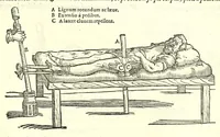 An illustration from Galeni librorum septima classis : curativum methodum tum diffuse tum breviter descriptam, victus rationem in morbis acutis, singulorum morborum facile paranda remedia, privatam quorundam morborum curationem, chirurgie constitutionem, fracturarum ac luxationum sanationem, fasciarum deniq ; & laqueorum & machinamentorum tractatum continet (1576)