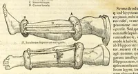 An illustration from Galeni librorum septima classis : curativum methodum tum diffuse tum breviter descriptam, victus rationem in morbis acutis, singulorum morborum facile paranda remedia, privatam quorundam morborum curationem, chirurgie constitutionem, fracturarum ac luxationum sanationem, fasciarum deniq ; & laqueorum & machinamentorum tractatum continet (1576)