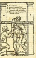 An illustration from Galeni librorum septima classis : curativum methodum tum diffuse tum breviter descriptam, victus rationem in morbis acutis, singulorum morborum facile paranda remedia, privatam quorundam morborum curationem, chirurgie constitutionem, fracturarum ac luxationum sanationem, fasciarum deniq ; & laqueorum & machinamentorum tractatum continet (1576)