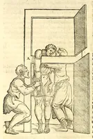 An illustration from Galeni librorum septima classis : curativum methodum tum diffuse tum breviter descriptam, victus rationem in morbis acutis, singulorum morborum facile paranda remedia, privatam quorundam morborum curationem, chirurgie constitutionem, fracturarum ac luxationum sanationem, fasciarum deniq ; & laqueorum & machinamentorum tractatum continet (1576)