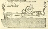 An illustration from Galeni librorum septima classis : curativum methodum tum diffuse tum breviter descriptam, victus rationem in morbis acutis, singulorum morborum facile paranda remedia, privatam quorundam morborum curationem, chirurgie constitutionem, fracturarum ac luxationum sanationem, fasciarum deniq ; & laqueorum & machinamentorum tractatum continet (1576)