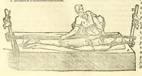An illustration from Galeni librorum septima classis : curativum methodum tum diffuse tum breviter descriptam, victus rationem in morbis acutis, singulorum morborum facile paranda remedia, privatam quorundam morborum curationem, chirurgie constitutionem, fracturarum ac luxationum sanationem, fasciarum deniq ; & laqueorum & machinamentorum tractatum continet (1576)
