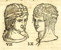 An illustration from Galeni librorum septima classis : curativum methodum tum diffuse tum breviter descriptam, victus rationem in morbis acutis, singulorum morborum facile paranda remedia, privatam quorundam morborum curationem, chirurgie constitutionem, fracturarum ac luxationum sanationem, fasciarum deniq ; & laqueorum & machinamentorum tractatum continet (1576)