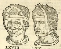 An illustration from Galeni librorum septima classis : curativum methodum tum diffuse tum breviter descriptam, victus rationem in morbis acutis, singulorum morborum facile paranda remedia, privatam quorundam morborum curationem, chirurgie constitutionem, fracturarum ac luxationum sanationem, fasciarum deniq ; & laqueorum & machinamentorum tractatum continet (1576)