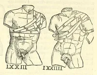 Picture 63 of 94 from Galeni librorum septima classis : curativum methodum tum diffuse tum breviter descriptam, victus rationem in morbis acutis, singulorum morborum facile paranda remedia, privatam quorundam morborum curationem, chirurgie constitutionem, fracturarum ac luxationum sanationem, fasciarum deniq ; & laqueorum & machinamentorum tractatum continet (1576), leaf 623