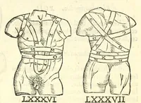 An illustration from Galeni librorum septima classis : curativum methodum tum diffuse tum breviter descriptam, victus rationem in morbis acutis, singulorum morborum facile paranda remedia, privatam quorundam morborum curationem, chirurgie constitutionem, fracturarum ac luxationum sanationem, fasciarum deniq ; & laqueorum & machinamentorum tractatum continet (1576)