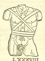 An illustration from Galeni librorum septima classis : curativum methodum tum diffuse tum breviter descriptam, victus rationem in morbis acutis, singulorum morborum facile paranda remedia, privatam quorundam morborum curationem, chirurgie constitutionem, fracturarum ac luxationum sanationem, fasciarum deniq ; & laqueorum & machinamentorum tractatum continet (1576)