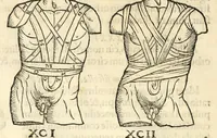 Picture 69 of 94 from Galeni librorum septima classis : curativum methodum tum diffuse tum breviter descriptam, victus rationem in morbis acutis, singulorum morborum facile paranda remedia, privatam quorundam morborum curationem, chirurgie constitutionem, fracturarum ac luxationum sanationem, fasciarum deniq ; & laqueorum & machinamentorum tractatum continet (1576), leaf 626