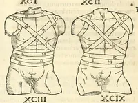 An illustration from Galeni librorum septima classis : curativum methodum tum diffuse tum breviter descriptam, victus rationem in morbis acutis, singulorum morborum facile paranda remedia, privatam quorundam morborum curationem, chirurgie constitutionem, fracturarum ac luxationum sanationem, fasciarum deniq ; & laqueorum & machinamentorum tractatum continet (1576)