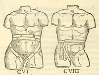 An illustration from Galeni librorum septima classis : curativum methodum tum diffuse tum breviter descriptam, victus rationem in morbis acutis, singulorum morborum facile paranda remedia, privatam quorundam morborum curationem, chirurgie constitutionem, fracturarum ac luxationum sanationem, fasciarum deniq ; & laqueorum & machinamentorum tractatum continet (1576)