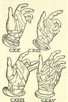 An illustration from Galeni librorum septima classis : curativum methodum tum diffuse tum breviter descriptam, victus rationem in morbis acutis, singulorum morborum facile paranda remedia, privatam quorundam morborum curationem, chirurgie constitutionem, fracturarum ac luxationum sanationem, fasciarum deniq ; & laqueorum & machinamentorum tractatum continet (1576)