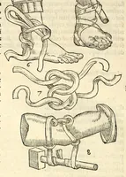 An illustration from Galeni librorum septima classis : curativum methodum tum diffuse tum breviter descriptam, victus rationem in morbis acutis, singulorum morborum facile paranda remedia, privatam quorundam morborum curationem, chirurgie constitutionem, fracturarum ac luxationum sanationem, fasciarum deniq ; & laqueorum & machinamentorum tractatum continet (1576)