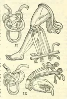 An illustration from Galeni librorum septima classis : curativum methodum tum diffuse tum breviter descriptam, victus rationem in morbis acutis, singulorum morborum facile paranda remedia, privatam quorundam morborum curationem, chirurgie constitutionem, fracturarum ac luxationum sanationem, fasciarum deniq ; & laqueorum & machinamentorum tractatum continet (1576)