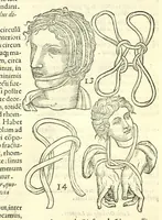 An illustration from Galeni librorum septima classis : curativum methodum tum diffuse tum breviter descriptam, victus rationem in morbis acutis, singulorum morborum facile paranda remedia, privatam quorundam morborum curationem, chirurgie constitutionem, fracturarum ac luxationum sanationem, fasciarum deniq ; & laqueorum & machinamentorum tractatum continet (1576)
