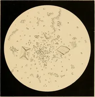 Picture 22 of 89 from An atlas of clinical microscopy (1885), leaf 106