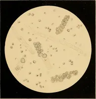 Picture 37 of 89 from An atlas of clinical microscopy (1885), leaf 162