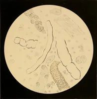 An illustration from An atlas of clinical microscopy (1885)