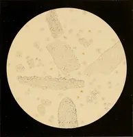 Picture 40 of 89 from An atlas of clinical microscopy (1885), leaf 172