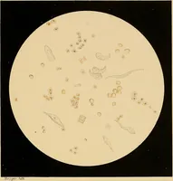 An illustration from An atlas of clinical microscopy (1885)