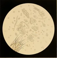 Picture 43 of 89 from An atlas of clinical microscopy (1885), leaf 186