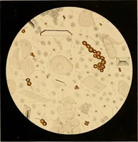 Picture 45 of 89 from An atlas of clinical microscopy (1885), leaf 192