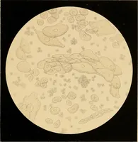 Picture 56 of 89 from An atlas of clinical microscopy (1885), leaf 232