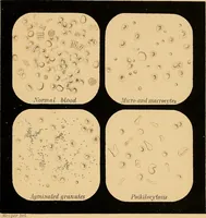 An illustration from An atlas of clinical microscopy (1885)