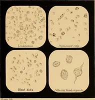 An illustration from An atlas of clinical microscopy (1885)