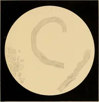 Picture 67 of 89 from An atlas of clinical microscopy (1885), leaf 284