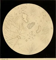 Picture 68 of 89 from An atlas of clinical microscopy (1885), leaf 288