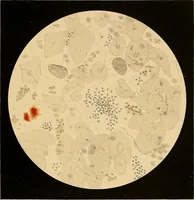 Picture 69 of 89 from An atlas of clinical microscopy (1885), leaf 292