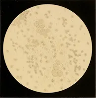 Picture 78 of 89 from An atlas of clinical microscopy (1885), leaf 328