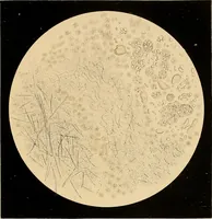 An illustration from An atlas of clinical microscopy (1885)