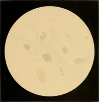 Picture 6 of 89 from An atlas of clinical microscopy (1885), leaf 56