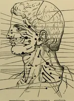 Picture 2 of 35 from An atlas of the differential diagnosis of the diseases of the nervous system; analytical and semeiological neurological charts (1914), leaf 113
