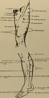 An illustration from An atlas of the differential diagnosis of the diseases of the nervous system; analytical and semeiological neurological charts (1914)
