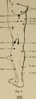 Picture 6 of 35 from An atlas of the differential diagnosis of the diseases of the nervous system; analytical and semeiological neurological charts (1914), leaf 114