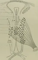 Picture 11 of 35 from An atlas of the differential diagnosis of the diseases of the nervous system; analytical and semeiological neurological charts (1914), leaf 313