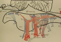 Picture 12 of 35 from An atlas of the differential diagnosis of the diseases of the nervous system; analytical and semeiological neurological charts (1914), leaf 314