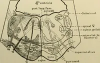 Picture 13 of 35 from An atlas of the differential diagnosis of the diseases of the nervous system; analytical and semeiological neurological charts (1914), leaf 315