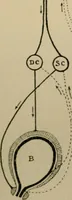 Picture 26 of 35 from An atlas of the differential diagnosis of the diseases of the nervous system; analytical and semeiological neurological charts (1914), leaf 320