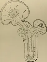 Picture 32 of 35 from An atlas of the differential diagnosis of the diseases of the nervous system; analytical and semeiological neurological charts (1914), leaf 324
