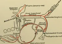 Picture 33 of 35 from An atlas of the differential diagnosis of the diseases of the nervous system; analytical and semeiological neurological charts (1914), leaf 325